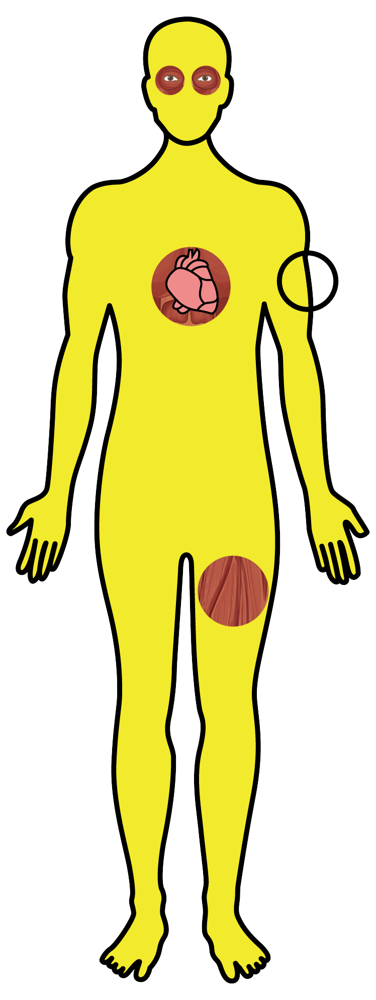 Cisticercose - Desenho corpo