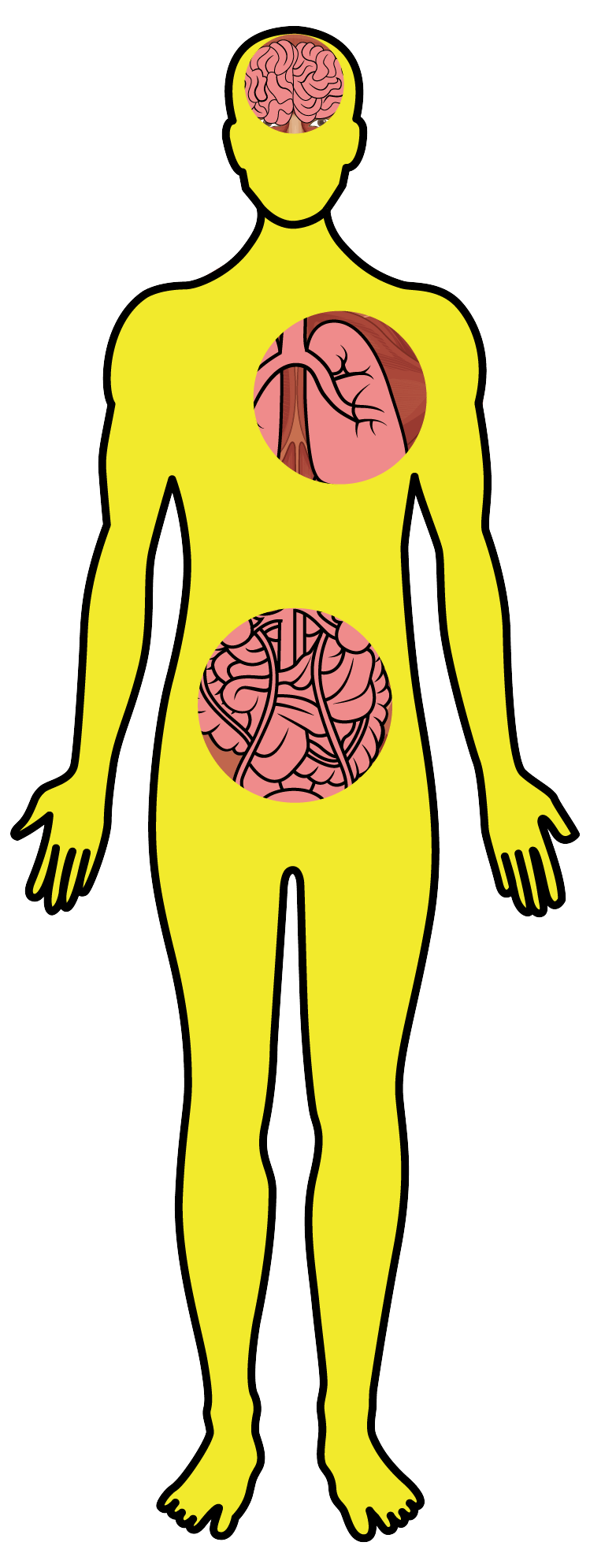 Botulismo - Desenho corpo
