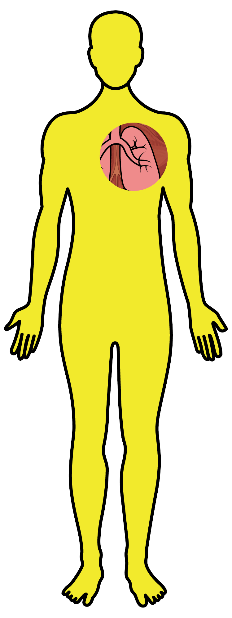 Tuberculose - Desenho corpo