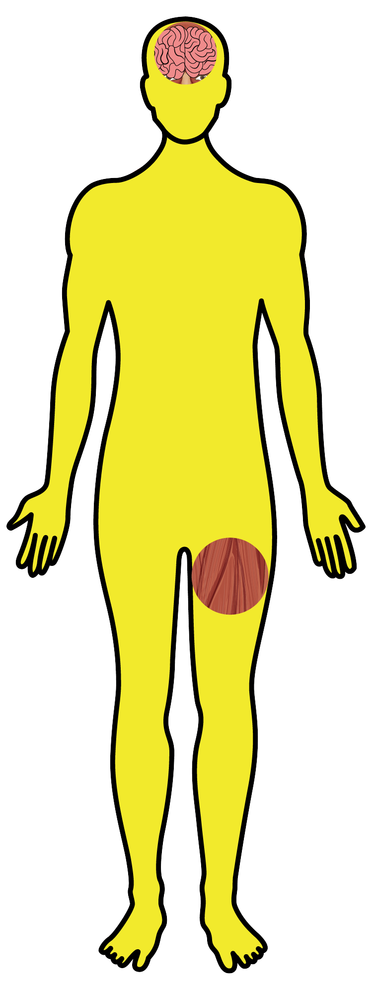 Toxoplasmose - Desenho corpo